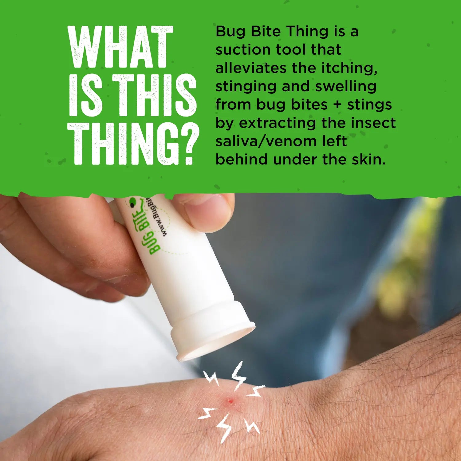 Bug Bite Relief Suction Tool - White
